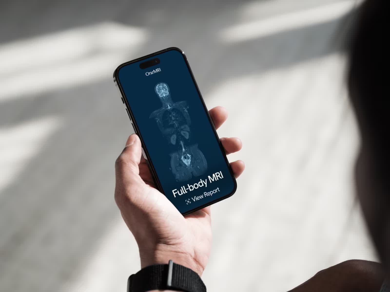 OneMRI Full Body MRI report viewed on a mobile phone